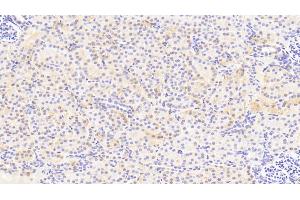 Detection of APOE in Human Kidney Tissue using Polyclonal Antibody to Apolipoprotein E (APOE)