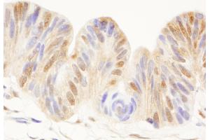 Immunohistochemistry (IHC) image for anti-Cell Division Cycle 25 Homolog C (S. Pombe) (CDC25C) (AA 150-200) antibody (ABIN7454534) (CDC25C anticorps  (AA 150-200))
