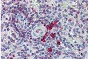 Image no. 2 for anti-Linker For Activation of T Cells Family, Member 2 (LAT2) (AA 91-243) antibody (ABIN238343)