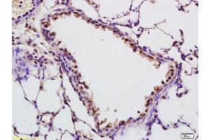 Formalin-fixed and paraffin embedded rat lung labeled with Anti-SAP62 Polyclonal Antibody, Unconjugated (ABIN1385973) at 1:200 followed by conjugation to the secondary antibody