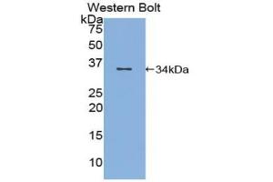 Western blot analysis of the recombinant protein. (Topoisomerase I anticorps  (AA 1-250))