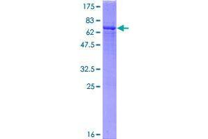 Image no. 1 for GDP-Mannose Pyrophosphorylase B (GMPPB) (AA 1-360) protein (GST tag) (ABIN1355310)