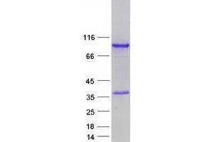 Validation with Western Blot