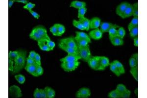 Immunofluorescence staining of HepG2 cells with ABIN7145438 at 1:66, counter-stained with DAPI.