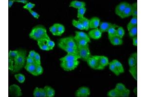 Immunofluorescence staining of HepG2 cells with ABIN7145438 at 1:66, counter-stained with DAPI. (ADRBK2 anticorps  (AA 343-480))