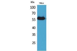 Western Blotting (WB) image for anti-Amylase (AMY) (N-Term) antibody (ABIN3187706)