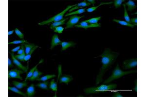 Immunofluorescence of purified MaxPab antibody to PPIA on HeLa cell.