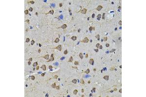 Immunohistochemistry of paraffin-embedded rat brain using N6AMT1 Antibody (ABIN5974334) at dilution of 1/100 (40x lens). (N6AMT1 anticorps)