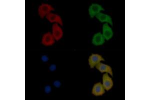 NMDAR2B Mouse Monoclonal Antibody staining Hela cells by IF/ICC.