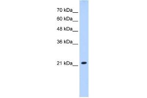 WB Suggested Anti-SLC25A14 Antibody Titration:  2. (SLC25A14 anticorps  (N-Term))