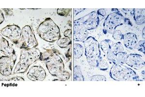 Immunohistochemistry analysis of paraffin-embedded human placenta tissue using MT-ND1 polyclonal antibody . (MT-ND1 anticorps)