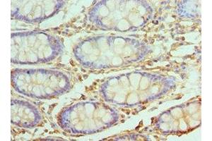 Immunohistochemistry of paraffin-embedded human colon tissue using ABIN7174493 at dilution of 1:100 (UBE2V2 anticorps  (AA 1-145))
