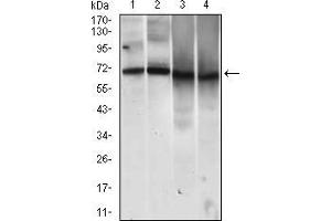 Western blot analysis using MCAM mouse mAb against HUVE-12 (1), EVC-304 (2), HELA (3) and MCF-7 (4) cell lysate. (MCAM anticorps  (AA 84-189))
