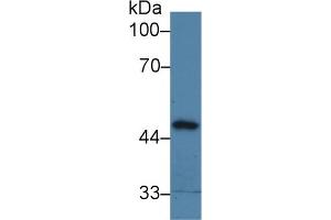 Detection of PPM1A in Porcine Liver lysate using Polyclonal Antibody to Protein Phosphatase, Mg2+/Mn2+ Dependent 1A (PPM1A) (PPM1A anticorps  (AA 2-382))