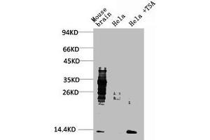 Western blot analysis of 1) Mouse Brain Tissue, 2) Hela, 3) Hela+TSA Treated using Acetyl Lysine Monoclonal Antibody. (Acetylated Lysine anticorps)