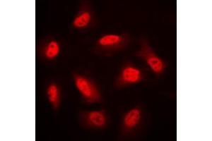 Immunofluorescent analysis of AMPK beta 1 staining in HeLa cells. (PRKAB1 anticorps  (N-Term))