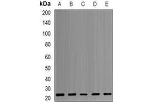 Western blot analysis of PSMB1 expression in MCF7 (A), HepG2 (B), K562 (C), PC3 (D), mouse liver (E) whole cell lysates. (PSMB1 anticorps)