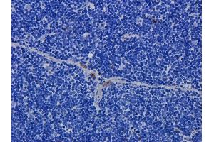 Immunohistochemical staining of rat thymus tissue using anti-CD52 antibody.