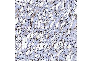 IHC analysis of SF3B3 using anti-SF3B3 antibody (ABIN7602378).