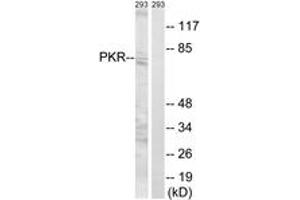 Western blot analysis of extracts from 293 cells, using PKR (Ab-258) Antibody. (EIF2AK2 anticorps  (AA 226-275))