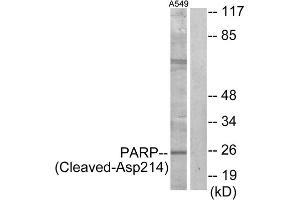 Western blot analysis of extracts from A549 cells, treated with etoposide (25uM, 24hours), using PARP (Cleaved-Asp214) antibody. (PARP1 anticorps  (Cleaved-Asp214))