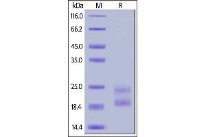 Biotinylated Human IL17A, His,Avitag on  under reducing (R) condition.