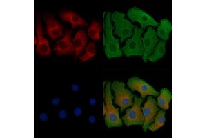 ABIN6257471 and ABIN6274750 staining Hela cells by IF/ICC. (RPS18 anticorps  (C-Term))