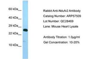 Image no. 1 for anti-NADH Dehydrogenase (Ubiquinone) Flavoprotein 2, 24kDa (NDUFV2) (AA 32-81) antibody (ABIN6749939) (NDUFV2 anticorps  (AA 32-81))