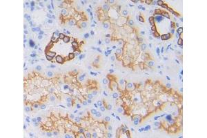 IHC-P analysis of kidney tissue, with DAB staining. (PTPRA anticorps  (AA 624-800))