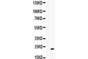 Observed bind size: 23KD (GREM1 anticorps  (C-Term))