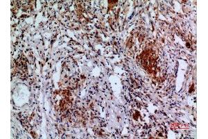 Immunohistochemistry (IHC) analysis of paraffin-embedded Human Lung, antibody was diluted at 1:100. (APAF1 anticorps  (Internal Region))