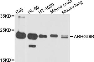 Western blot analysis of extracts of various cell lines, using ARHGDIB antibody (ABIN5971929) at 1/1000 dilution. (ARHGDIB anticorps)