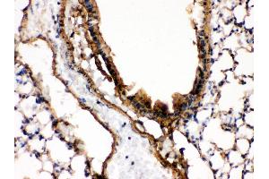 IHC(P): Mouse Lung Tissue (MAP2K7 anticorps  (N-Term))