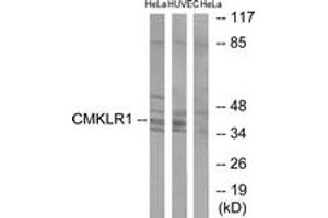 Western blot analysis of extracts from HeLa/HuvEc cells, using CMKLR1 Antibody.