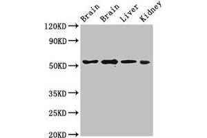 Western Blot Positive WB detected in: Rat brain tissue, Mouse brain tissue, Mouse liver tissue, Mouse kidney tissue All lanes: PPP2R2A antibody at 3 μg/mL Secondary Goat polyclonal to rabbit IgG at 1/50000 dilution Predicted band size: 52, 53 kDa Observed band size: 52 kDa