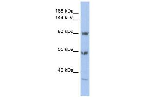 TPCN1 antibody used at 1 ug/ml to detect target protein.