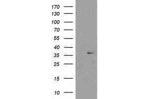 Western Blotting (WB) image for anti-Nudix (Nucleoside Diphosphate Linked Moiety X)-Type Motif 6 (NUDT6) antibody (ABIN1499867) (NUDT6 anticorps)
