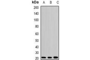 Western blot analysis of H-Ras expression in SKOV3 (A), mouse kidney (B), rat brain (C) whole cell lysates. (HRAS anticorps)
