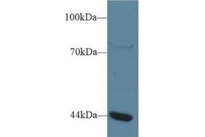 Western blot analysis of Human Jurkat cell lysate, using Human GTF3A Antibody (1 µg/ml) and HRP-conjugated Goat Anti-Rabbit antibody ( (GTF3A anticorps  (AA 71-365))