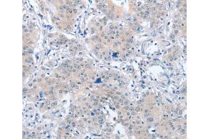 Immunohistochemistry (IHC) image for anti-Par-6 Partitioning Defective 6 Homolog alpha (PARD6A) antibody (ABIN2428552) (PARD6A anticorps)