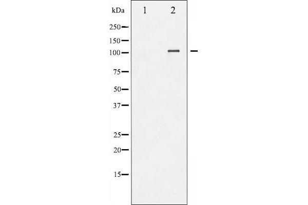 NFATC3 anticorps  (pSer165)