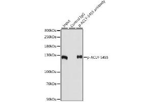 Immunoprecipitation analysis of 200 μg extracts of NIH/3T3 cells, using 3 μg Phospho-ACLY-S455 pAb (ABIN6135178, ABIN6136002, ABIN6136003 and ABIN6225678).