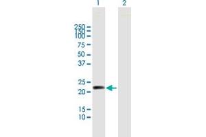 Western Blot analysis of MYL5 expression in transfected 293T cell line by MYL5 MaxPab polyclonal antibody. (MYL5 anticorps  (AA 1-173))
