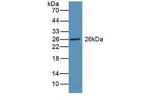 Western blot analysis of recombinant Rat RBP3.