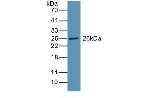 Western blot analysis of recombinant Rat RBP3. (RBP3 anticorps  (AA 1027-1229))