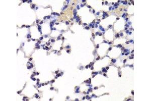 Immunohistochemistry of paraffin-embedded Mouse lung using INTS6 Polyclonal Antibody at dilution of 1:100 (40x lens). (INTS6 anticorps)