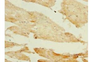 Immunohistochemistry of paraffin-embedded human skeletal muscle tissue using ABIN7163163 at dilution of 1:100