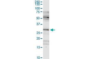 FHL2 MaxPab rabbit polyclonal antibody. (FHL2 anticorps  (AA 1-279))