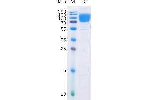 Human B7-2 Protein, mFc-His Tag on SDS-PAGE under reducing condition.