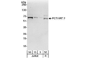 Western Blotting (WB) image for anti-Cyclin-Dependent Kinase 17 (CDK17) (AA 1-50) antibody (ABIN7454553)